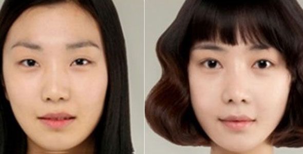 korean-plastic-surgery-dramatic1.jpg